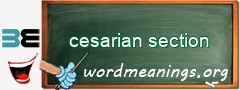 WordMeaning blackboard for cesarian section